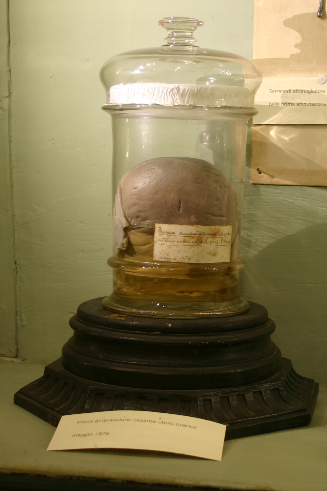 Edoardo Porro's memorabilia, Museo per la Storia dell'Università, Pavia - 04.JPG